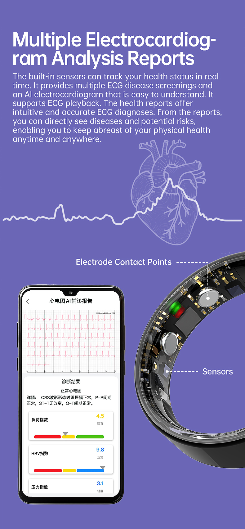 Wolf Sentinel ECG Smart Ring - ECG AI analysis view